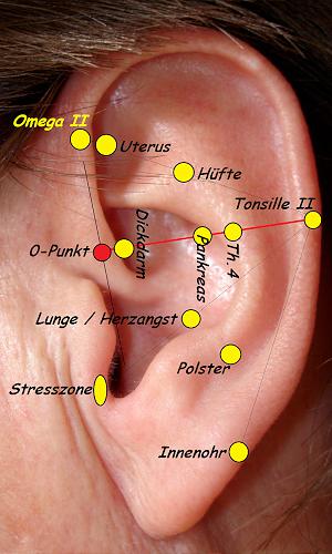 129.  Tinnitus Fall II, linkes Ohr